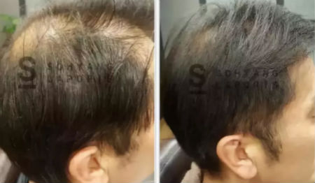 唯拾壹跨境美妝|我缺的不是卷發(fā)棒！不是錢！是頭發(fā)啊