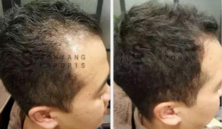 唯拾壹跨境美妝|我缺的不是卷發(fā)棒！不是錢！是頭發(fā)啊