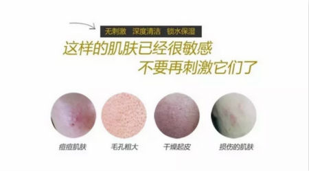 NewNewDIY|敏感肌如何選洗面奶？皮膚科醫(yī)生推薦這款！