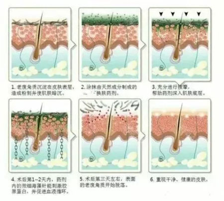 堪稱(chēng)“換臉”的神奇煥膚術(shù)，你get了嗎？