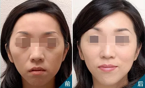 無針?biāo)?，憑什么讓女性為之瘋狂和傾倒？！