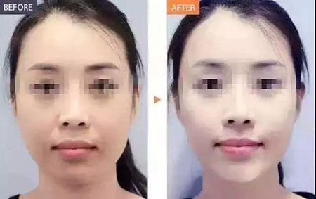 還在靠敷面膜補(bǔ)水？那你的皮膚肯定出問(wèn)題！