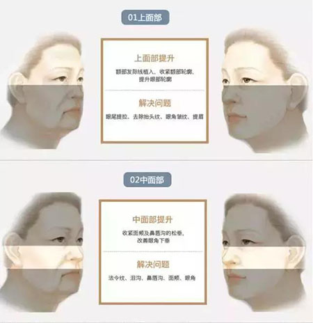 她只是做了個(gè)黃金V雕，3年后結(jié)果震驚了所有人！
