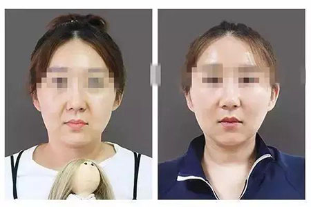 她只是做了個(gè)黃金V雕，3年后結(jié)果震驚了所有人！