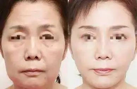她只是做了個(gè)黃金V雕，3年后結(jié)果震驚了所有人！