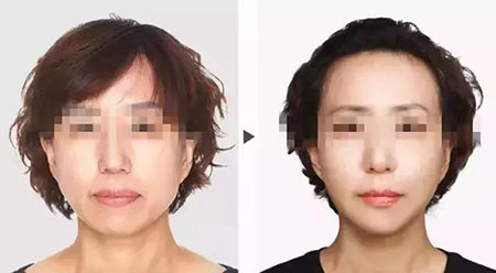 她只是做了個(gè)黃金V雕，3年后結(jié)果震驚了所有人！