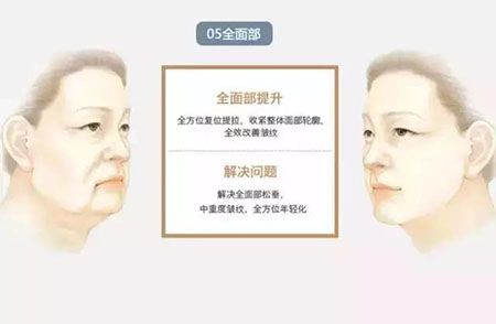 她只是做了個(gè)黃金V雕，3年后結(jié)果震驚了所有人！