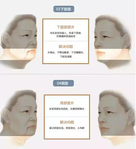 她只是做了個(gè)黃金V雕，3年后結(jié)果震驚了所有人！