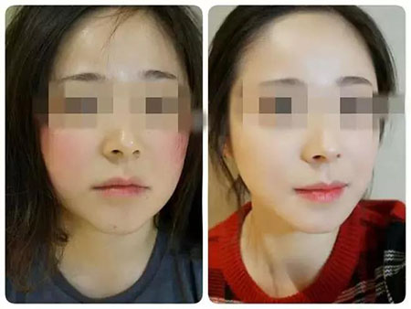 拒絕春季過敏、紅腫、發(fā)癢！敏感肌的救星來啦~