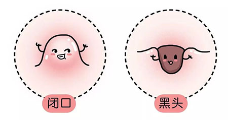 “閉口”這個(gè)磨人的小妖精又出來作妖啦！