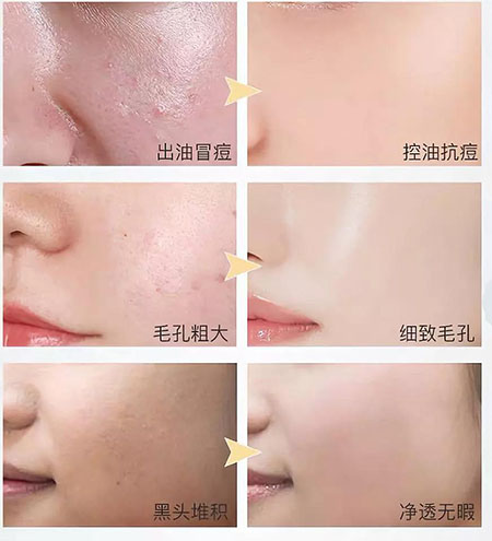 韓詩(shī)緹教你正確洗臉，現(xiàn)在！立刻！馬上！改善皮膚問(wèn)題