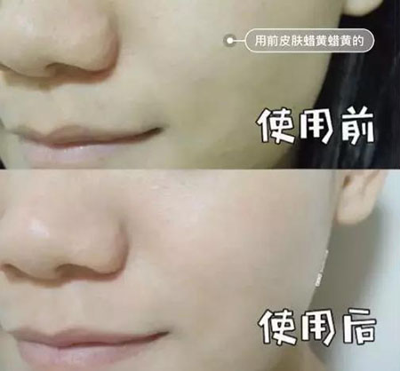這款『韓詩緹童顏逆齡禮盒』，竟然能破衰老的魔咒？！