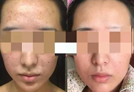 粉絲真實測評！DIY私人定制護膚品真有那么神奇嗎？