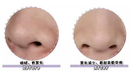 女人總愛摸這里，難怪會毀容，99%的人都中招！