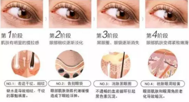 講真，少女感的秘密全藏在這款韓詩緹凈雪眼霜里...