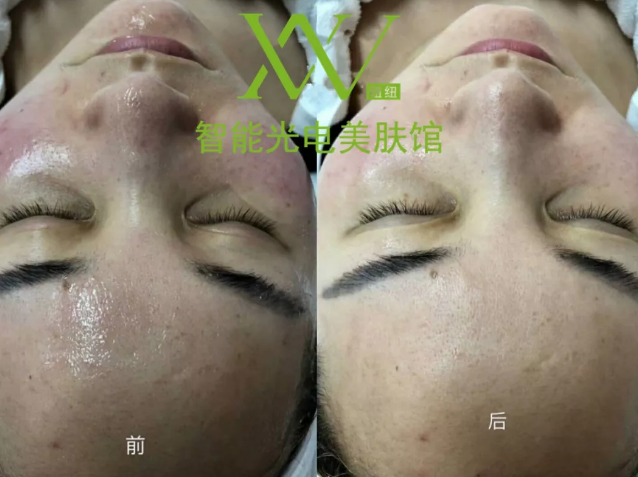 “一洗白”能變白？假的！它才是美白正確的打開方式
