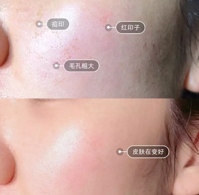 “一洗白”能變白？假的！它才是美白正確的打開方式