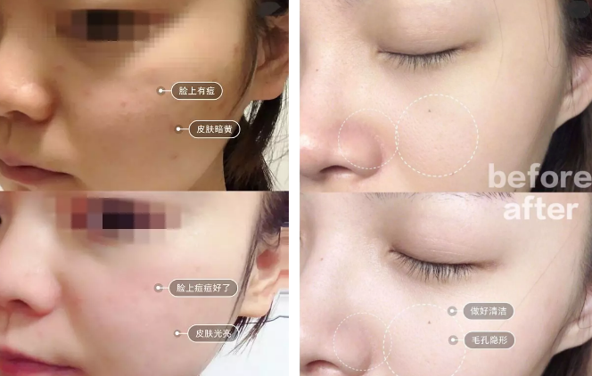 “一洗白”能變白？假的！它才是美白正確的打開方式