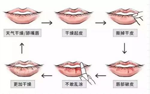 誰(shuí)說(shuō)夏天不用護(hù)唇膏?沒(méi)有它，再貴的口紅都沒(méi)用!