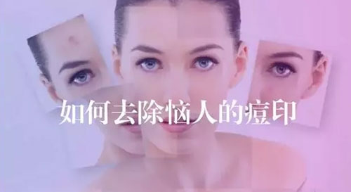 美容界的磨皮針——海藻煥膚，功效可不僅是祛痘這么簡單!