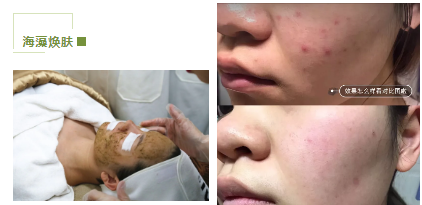 去暗黃、除色斑，VN美白管理讓你年輕十歲！