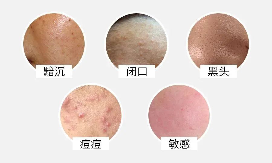 唯美度潔顏乳 | 調(diào)膚絕佳搭檔，洗出嫩滑牛奶肌