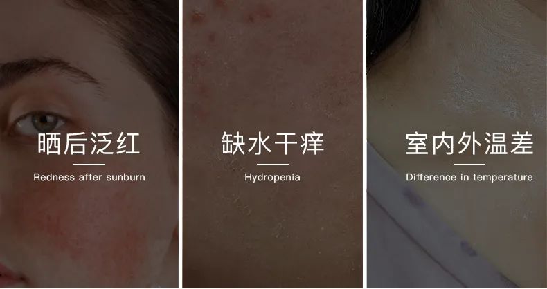 無(wú)懼時(shí)光，天生優(yōu)雅，敏感肌&受損肌的修護(hù)“膜”法